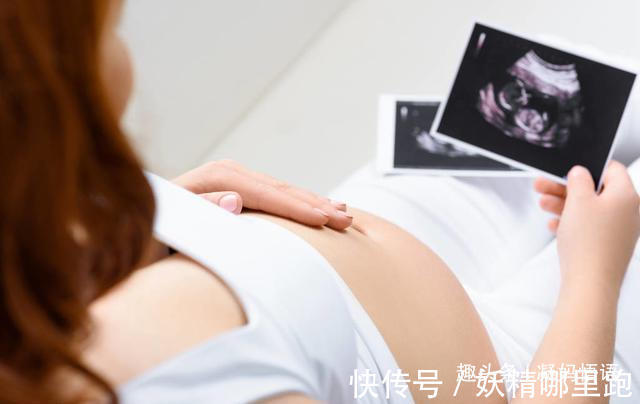 认识|孕期要做四维彩超,四维彩超的这些误区和认识,孕妈妈早知道早好