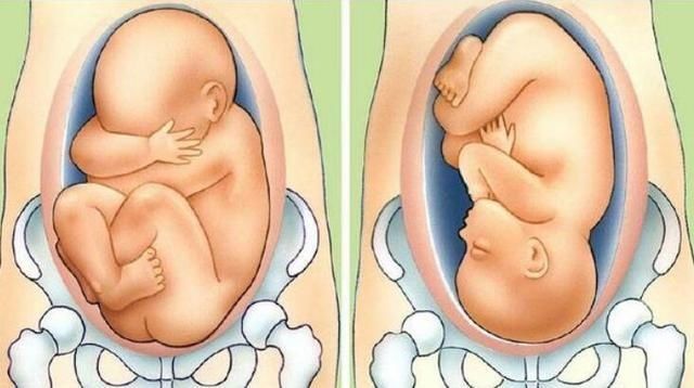 胎儿|到了这个孕周，胎儿“胎位”基本固定，以后再纠正就难了