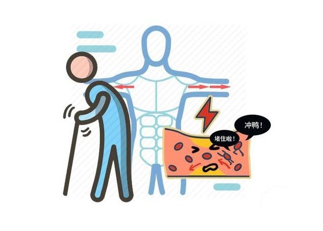 胃溃疡|吃饭喜欢做这3件事的人,不容易长寿,若你没有,值得高兴