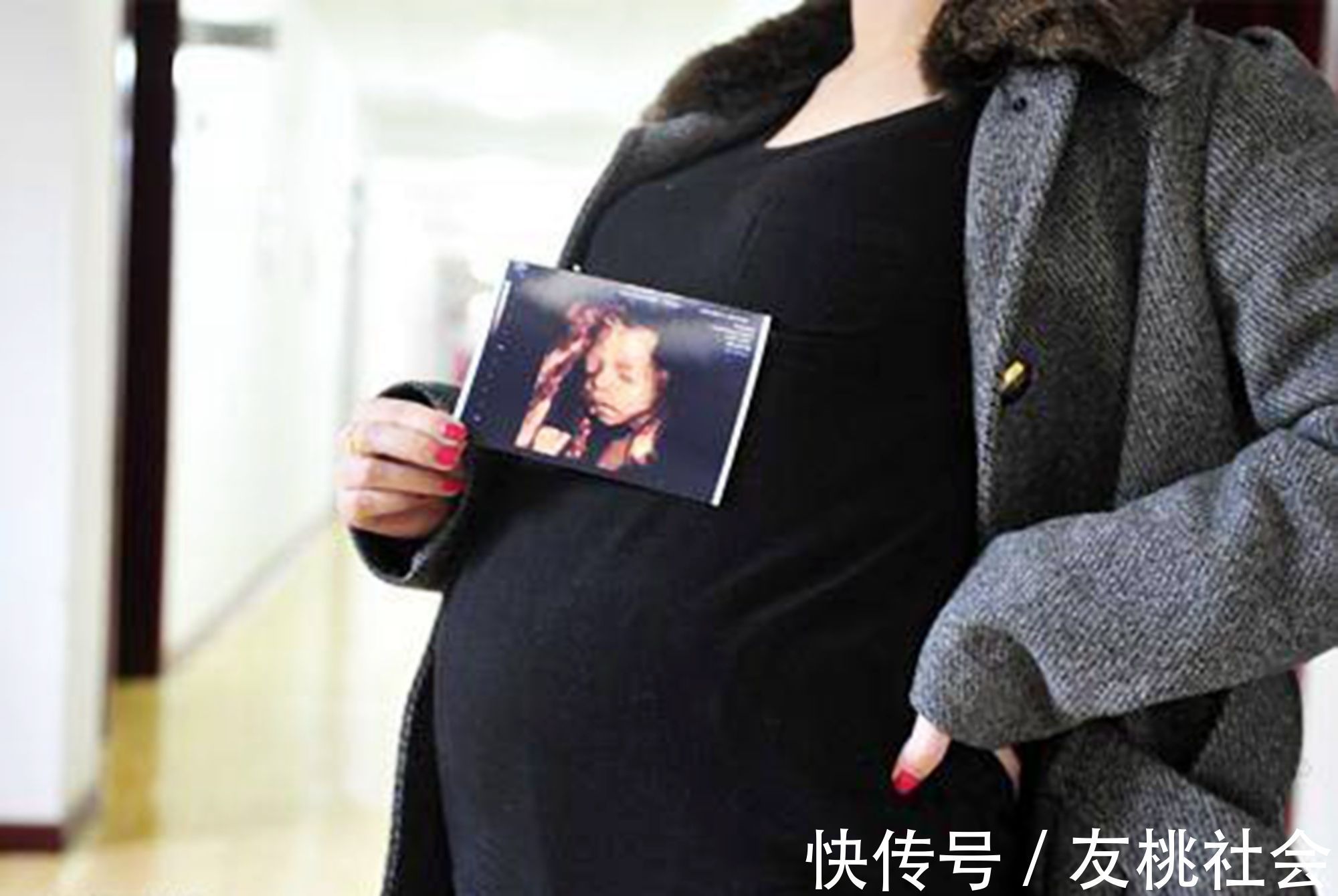 孕妈|产检做四维彩超,为什么“家属勿入”?其实是出于“三保护”原则