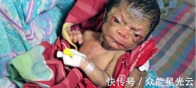 巴耶塞特|印度13岁少女嫁给亲哥哥,当他们孩子出生后,一家人大闹医院