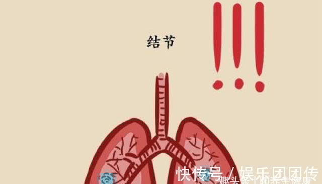 慢性疾病|医生提醒:体内有结节的人,5种发物尽量少吃,能忍住就是赢