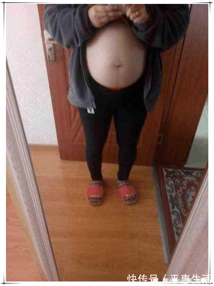 肚子|孕妇“悬垂肚”走红，网友猜测是“双胞胎”：没见过这样的孕肚