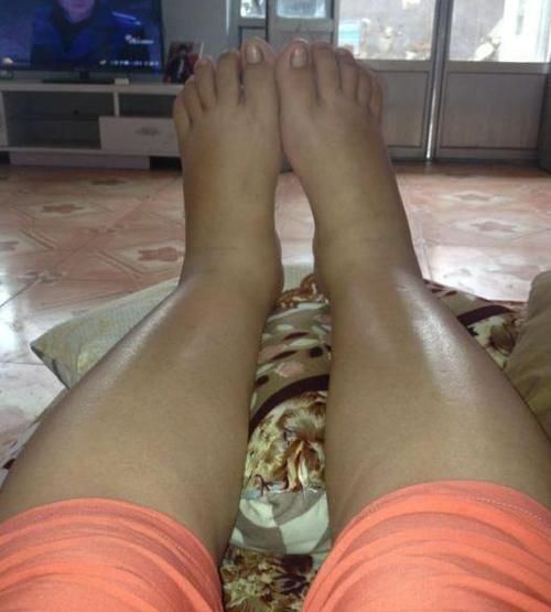 肺脏|养肺就是养命，养肺的好季节已到，医生：这3件事要尽早做