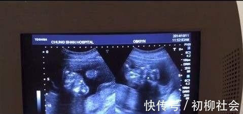 彩超|孕24周做彩超,胎儿不停地做鬼脸,孕妈得意之时,医生:再做一遍