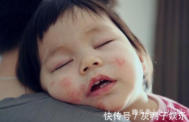 小雨|儿科医生建议最好别给宝宝吃鸡蛋羹,还在喂的家长,需要注意