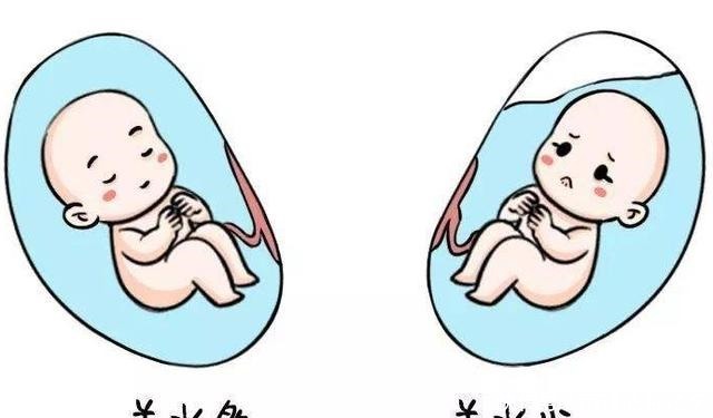 外国|外国女子切除部分子宫后仍怀孕,剖腹产诞下“生气宝宝”