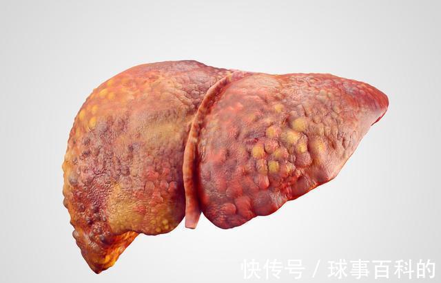 莲藕|肝不好,不能吃莲藕?提醒:少碰3物,肝脏慢慢变好