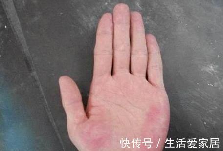 指甲|肝脏不好，手上会发出4个信号，若没有，说明肝脏还算健康