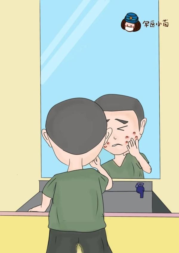 药物治疗|关于“痘痘”那些不得不说的事