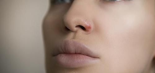 透过“唇色”看健康，嘴唇出现这六种现象，提示疾病已经“临门”