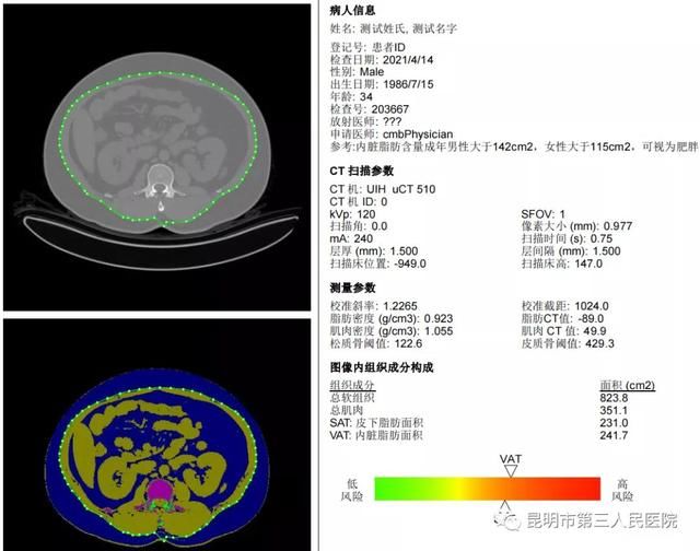 测定|搭载QCT软件的CT来了，看看能做什么？