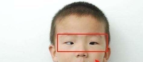 平板电脑|5岁男孩沉迷玩手机,黑眼珠逐渐“消失”,医生这孩子废了