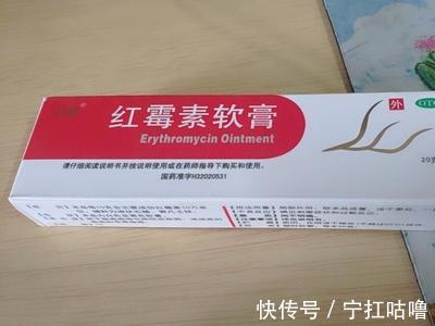 痔疮膏|痔疮患者自用痔疮膏测评,这款药膏帮你告别痔疮不再复发!