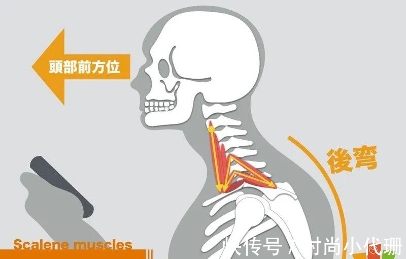 谣言|关于斜方肌的谣言,适可而止吧!