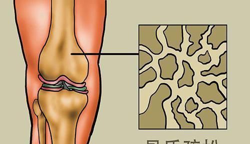 医生|经常喝牛奶和不喝牛奶的差异有多大医生50岁后你会慢慢明白