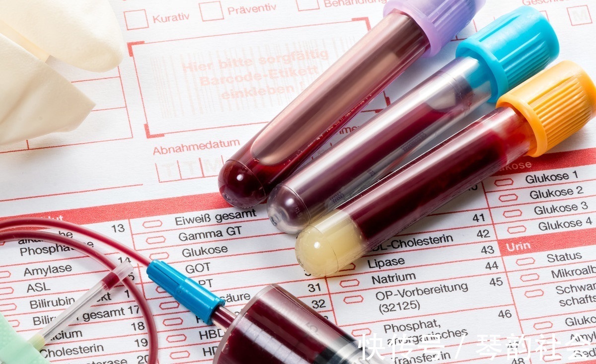 高血压|与高血压、高血脂、高血糖齐名称为“四高”，这项检查用处多