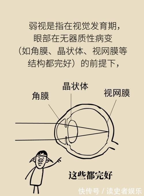 弱视|弱视的危害远大于近视?一个小游戏能辨认