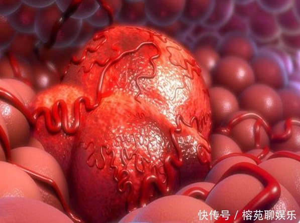 癌症来降临前,多伴有4种信号,教你3招,提前预防癌症,望周知