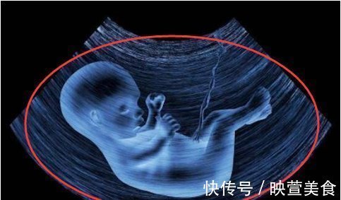 b超检查|孕24周B超检查,当看到宝宝的样子后,孕妈有些吓到了