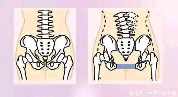 两侧肌肉|产后恢复好身材的最佳时间,千万别错过,顺序可以这样来