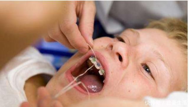 宝宝|宝宝长了一口“鲨鱼牙”,妈妈无奈送医求助,医生:怪家长无知