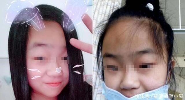 长大|这5种娃会越长越丑,长大也难逃“变丑”结局,希望你家娃没中招