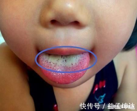 阳阳|儿科医生提醒:这3种肉是“虐”娃真凶,最伤孩子脾胃,家长少买