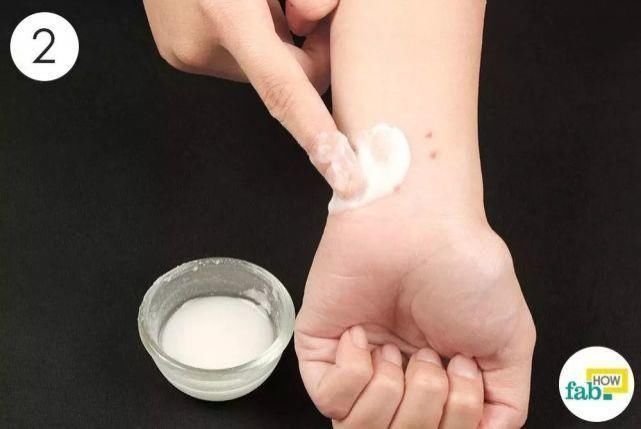 蚊子咬了别擦药,涂点这个马上止痒,还不花一分钱