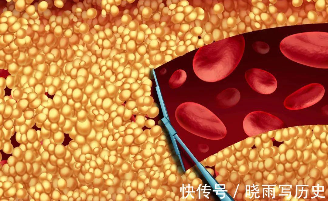 小事|血管被堵住，会给身体带来3大危害，保护血管要从这4件小事做起