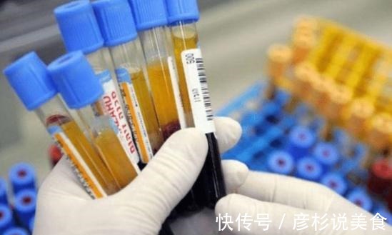 油炸食品|高血压患者不能吃洋葱若想稳定血压，真正不能吃的是这3物