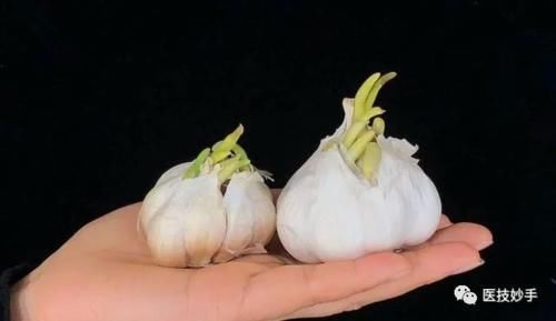 黄豆|发芽的蔬菜能不能吃?这4种蔬菜发芽后不仅没毒,反而营养更足