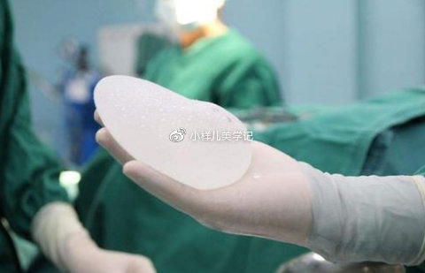 做假体隆胸，怎么确定自己适合哪种层次的隆胸方式呢？