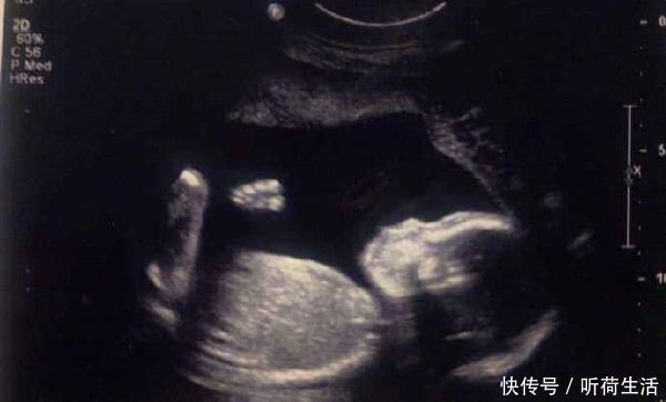 头胎|“头胎是来报恩的”,医生力保头胎的原因有4个,大多数人不知道