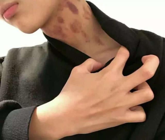 早恋|初二女生脖子长“草莓”，母亲一句话，拯救女儿恋爱观