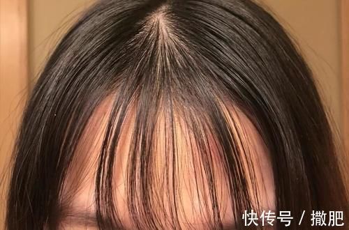 头发|头发经常出油看上去很邋遢?女生做到这些,不用每天洗头也很清爽