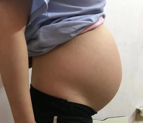 早孕期|过了早孕也不能放松警惕,这一阶段也有胎停,别不当回事