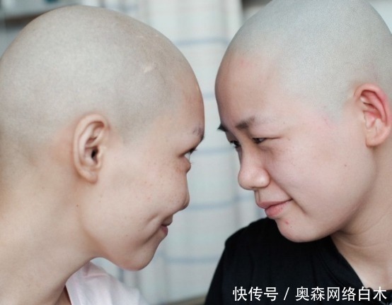 化疗|一旦得了癌症后,做化疗能多活几天,很多人难以接受