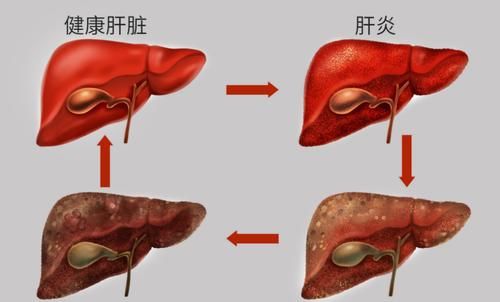 皮肤|42岁男子以为皮肤过敏,却查出肝硬化,医生:身体2处发痒,尽早做检查