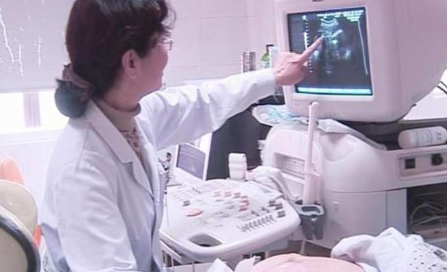 小月子|“头胎是来报恩的,要生下来”,医生道出真相,很多女性都不懂