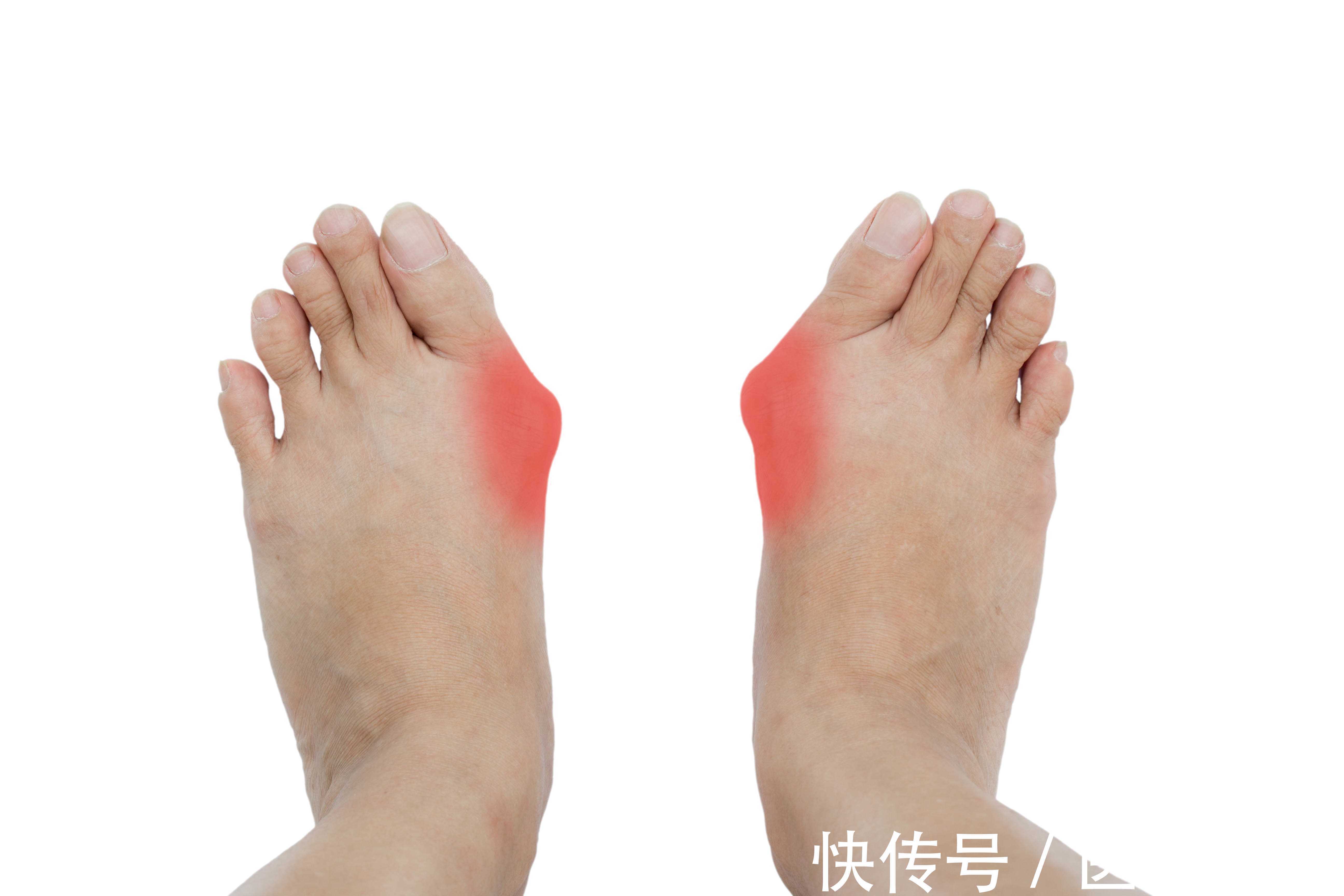 双脚|人老脚先衰?多留意双脚7种表现,若你有,或已进入衰老状态