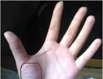 对症治疗|手掌上这块肉,一看就知道身体好不好!没事经常搓一搓,宣肺强心
