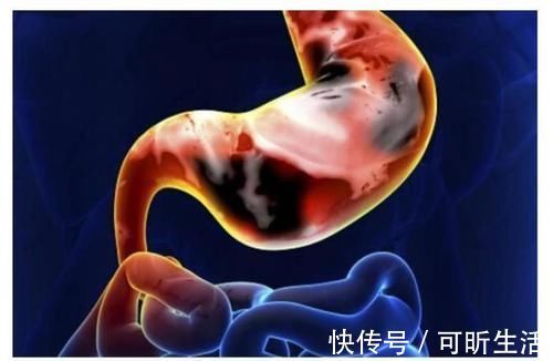 快餐|胃炎最怕5种食物,经常吃能养胃,记得不要乱吃这4种食物!