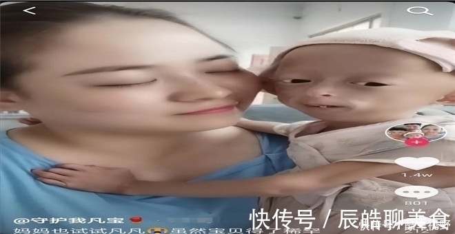 遗传病|七岁宝宝得了这种怪病，却不哭不闹帮妈妈照顾弟妹，疼痛时想睡觉