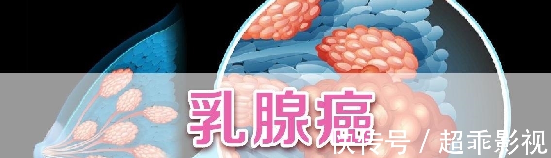 复发|姚贝娜查出乳腺癌时是早期,经过化疗已经痊愈,为何人还是没了?