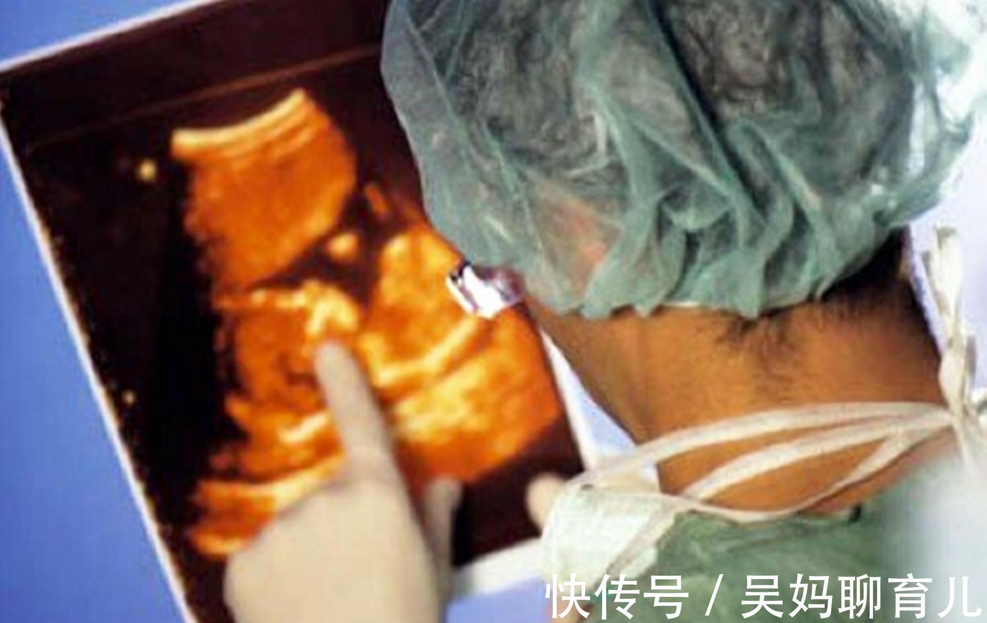 子宫|孕妈这3种行为,是让胎儿“宫内窒息”的罪魁祸首!