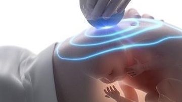 怀孕36周脐带绕颈3圈，羊水又偏少，该怎么办？