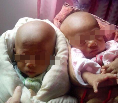 龙凤胎|宝妈顺利生下龙凤胎,医生抱孩子出来报喜,奶爸却打了孩子一耳光