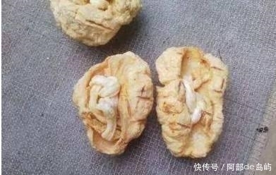 生完|生完孩子，胎盘是教给医院还是自己带走，看看他们是怎们处理？