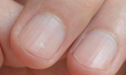 医院|身上出现这6个信号，尽快去医院检查一次肝功能，晚了就后悔吧